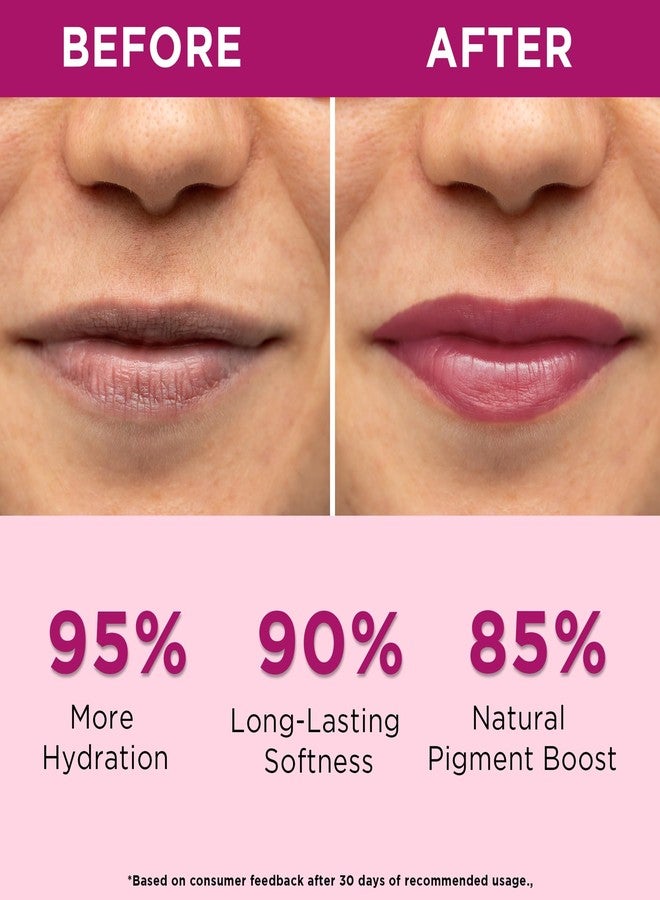 Orgatre Beetroot Lip Balm Tube with Ceramide, Kojic Acid & SPF 30 PA++ | Deep Moisturization & Pigmentation Care | Natural Beetroot Tint | Nourishes, Repairs & Protects Lips | 10ml - Pack of 2 - Image 2